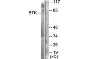 Western Blotting (WB) image for anti-Bruton Agammaglobulinemia tyrosine Kinase (BTK) (AA 188-237) antibody (ABIN2888587) (BTK antibody  (AA 188-237))