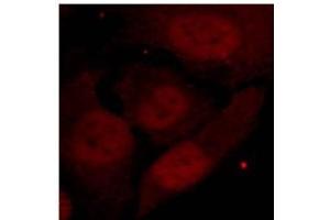 Image no. 2 for anti-Histone Deacetylase 2 (HDAC2) (pSer394) antibody (ABIN319237) (HDAC2 antibody  (pSer394))