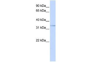 WB Suggested Anti-ETV3L Antibody Titration:  0. (ETV3L antibody  (C-Term))