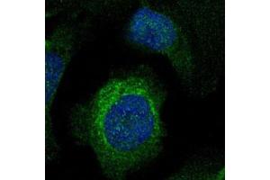 Immunofluorescent staining of U-2 OS with LIMCH1 polyclonal antibody  (Green) shows positivity in cytoplasm. (LIMCH1 antibody)