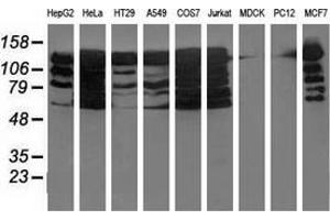 Western blot analysis of extracts (35 µg) from 9 different cell lines by using anti-BUB1B monoclonal antibody. (BUB1B antibody)