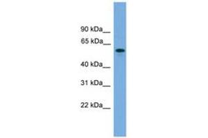 Image no. 1 for anti-MTOR associated protein, eak-7 homolog (MEAK7) (C-Term) antibody (ABIN6746516) (KIAA1609 antibody  (C-Term))