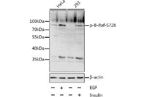 Western blot analysis of extracts of various cell lines, using Phospho-B-Raf-S728 antibody (ABIN6135192, ABIN6136028, ABIN6136029 and ABIN6225598). (BRAF antibody  (pSer728))
