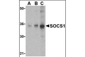Western blot analysis of SOCS1 in Human spleen cell lysate with this product at (A) 1, (B) 2 and (C) 4 μg/ml. (SOCS1 antibody  (N-Term))