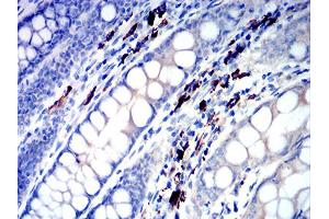 Immunohistochemical analysis of paraffin-embedded colon tissues using IGLC2 mouse mAb with DAB staining. (IGLC2 antibody  (AA 1-106))