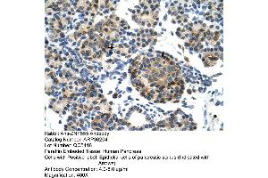 Human Pancreas (ZNF555 antibody  (N-Term))
