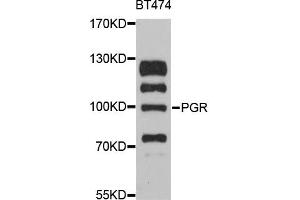 Western blot analysis of extracts of BT-474 cells, using PGR antibody.