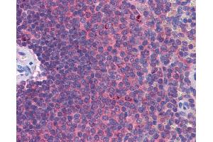 Anti-MDA5 antibody IHC of human spleen. (IFIH1 antibody  (AA 612-661))
