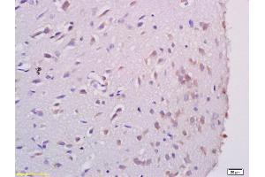 Formalin-fixed and paraffin embedded rat brain labeled with Anti AATF Polyclonal Antibody, Unconjugated (ABIN673689) at 1:200 followed by conjugation to the secondary antibody and DAB staining (AATF antibody  (AA 451-560))