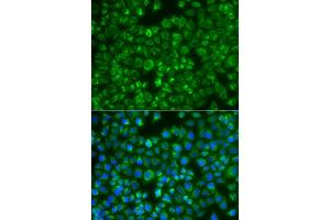 Immunofluorescence analysis of A549 cell using MTMR4 antibody.