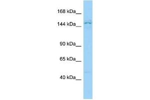 Host: Rabbit Target Name: PPP1R9A Sample Type: Jurkat Whole Cell lysates Antibody Dilution: 1. (PPP1R9A antibody  (N-Term))