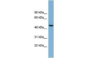 Human OVCAR-3; WB Suggested Anti-ALPPL2 Antibody Titration: 0. (ALPPL2 antibody  (Middle Region))
