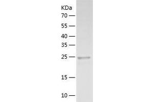Western Blotting (WB) image for Fibroblast Growth Factor Binding Protein 1 (FGFBP1) (AA 24-234) protein (His tag) (ABIN7287205) (FGFBP1 Protein (AA 24-234) (His tag))