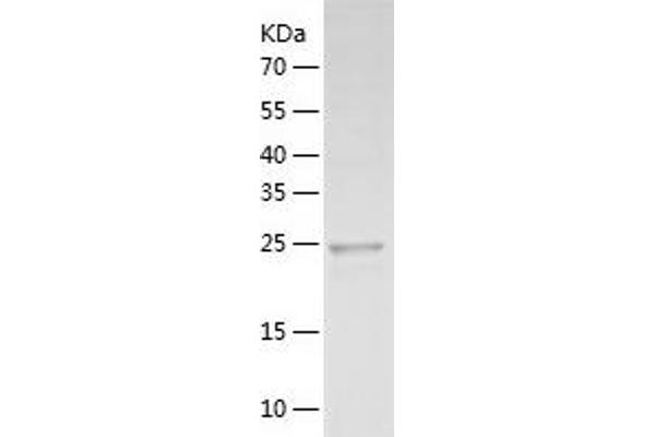 FGFBP1 Protein (AA 24-234) (His tag)