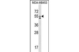 PTDSS1 Antibody (C-term) (ABIN1537254 and ABIN2848773) western blot analysis in MDA-M cell line lysates (35 μg/lane).