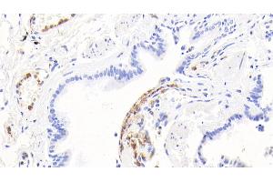 Detection of CALPRO in Human Lung Tissue using Polyclonal Antibody to Calprotectin (CALPRO) (S100A8/A9 Complex (Calprotectin) antibody  (AA 1-114))
