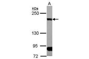 Image no. 1 for anti-CAP-GLY Domain Containing Linker Protein 1 (CLIP1) (N-Term) antibody (ABIN1494006)