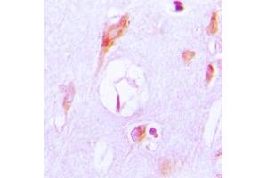 Immunohistochemical analysis of Cytochrome P450 27A1 staining in human brain formalin fixed paraffin embedded tissue section. (CYP27A1 antibody  (Center))