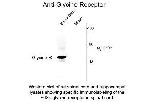 Western Blot of Anti-Glycine Receptor (Rabbit) Antibody - 600-401-D65 Western Blot of Rabbit anti-Glycine Receptor antibody. (Glycine Receptor (GRD) (N-Term) antibody)