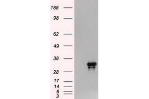 HEK293T cells were transfected with the pCMV6-ENTRY control (Left lane) or pCMV6-ENTRY Noggin (RC205020) (Right lane) cDNA for 48 hrs and lysed. (NOG antibody  (AA 28-232))