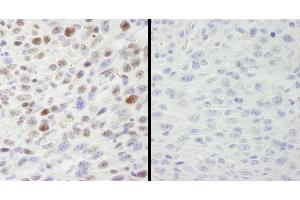 Immunohistochemistry (IHC) image for anti-Minichromosome Maintenance Complex Component 2 (MCM2) (pSer40), (pSer41) antibody (ABIN7448650)