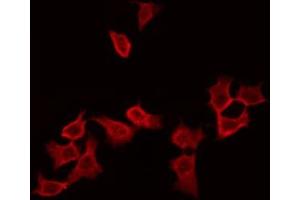 ABIN6272405 staining HepG2 by IF/ICC. (RAB11B antibody  (C-Term))