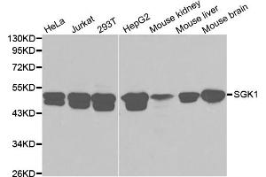 Western blot analysis of extracts of various cell lines, using SGK1 antibody (ABIN5970402) at 1/1000 dilution. (SGK1 antibody)