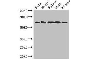 Western Blot Positive WB detected in: Hela whole cell lysate, Mouse heart tissue, Mouse spleen tissue, Mouse lung tissue, Mouse kidney tissue All lanes: ENTPD7 antibody at 2. (ENTPD7 antibody  (AA 51-350))