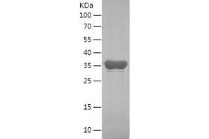 Western Blotting (WB) image for Insulin-Like Growth Factor 2 mRNA Binding Protein 3 (IGF2BP3) (AA 284-579) protein (His tag) (ABIN7283122) (IGF2BP3 Protein (AA 284-579) (His tag))