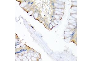 Immunohistochemistry of paraffin-embedded human colon using LRG1 antibody (ABIN5975207) at dilution of 1/100 (40x lens).
