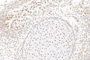 Immunohistochemistry (Paraffin-embedded Sections) (IHC (p)) image for anti-Growth Differentiation Factor 6 (GDF6) antibody (ABIN7074132)