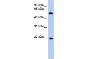 WB Suggested Anti-CRYGC Antibody Titration: 0. (CRYGC antibody  (Middle Region))