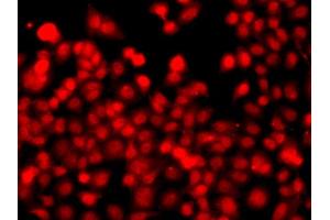 Immunofluorescence analysis of A549 cell using THAP1 antibody. (THAP1 antibody)