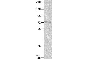Western blot analysis of Mouse eye tissue, using MUC20 Polyclonal Antibody at dilution of 1:1400 (MUC20 antibody)