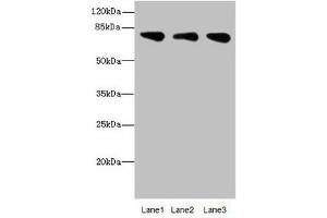 Western blot All lanes: ACSS2antibody at 2. (ACSS2 antibody  (AA 462-701))