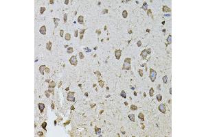 Immunohistochemistry of paraffin-embedded mouse brain using FGF2 antibody (ABIN1872685) at dilution of 1:100 (40x lens). (FGF2 antibody)