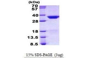 Figure annotation denotes ug of protein loaded and % gel used. (SRSF1 Protein)