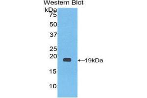 Western Blotting (WB) image for anti-Coagulation Factor VIII (F8) (AA 1887-2044) antibody (ABIN1858766) (Factor VIII antibody  (AA 1887-2044))