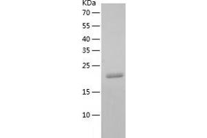 Western Blotting (WB) image for Pallidin Homolog (PLDN) (AA 1-172) protein (His tag) (ABIN7289366) (Pallidin Protein (AA 1-172) (His tag))
