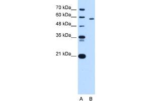 PKLR antibody - N-terminal region  validated by WB using HepG2 cell lysate at 1.