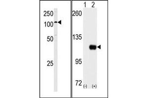 Image no. 2 for anti-Hexokinase 1 (HK1) (C-Term) antibody (ABIN360645)