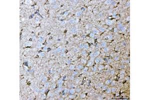IHC analysis of Septin 2/SEPTIN2 using anti-Septin 2/SEPTIN2 antibody (ABIN7599275).