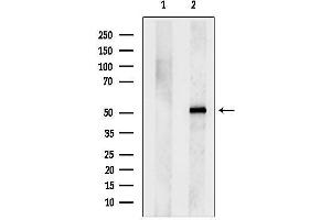 anti-Sphingomyelin Synthase 1 (SGMS1) (N-Term) antibody