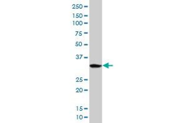 PPP1R3B antibody  (AA 1-285)