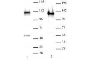 SMARCA1 / SNF2L1 antibody (rAb) tested by Western blot. (Recombinant SMARCA1 antibody)