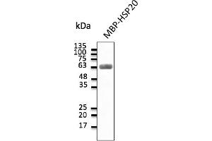 Western Blotting (WB) image for anti-Heat Shock Protein, alpha-Crystallin-Related, B6 (HSPB6) antibody (ABIN7273045) (HSPB6 antibody)