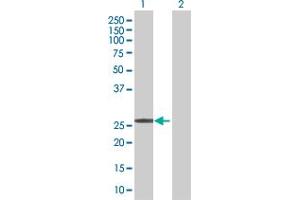 Lane 1: CDKN1B transfected lysate ( 22 KDa) Lane 2: Non-transfected lysate. (CDKN1B 293T Cell Transient Overexpression Lysate(Denatured))