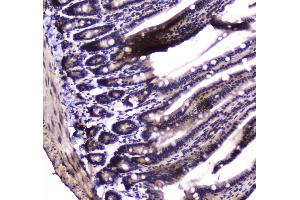 IHC analysis of PARN using anti-PARN antibody . (PARN antibody  (AA 1-301))