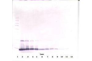 Image no. 1 for anti-Interleukin 4 (IL4) antibody (ABIN465482) (IL-4 antibody)