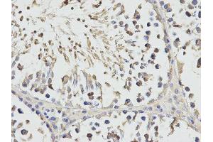 Immunohistochemistry (IHC) image for anti-Ribosomal Protein S3 (RPS3) antibody (ABIN1874658)